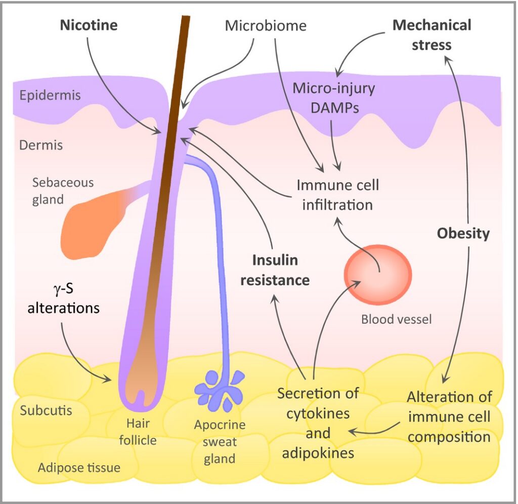 Your Body's Blueprint for Healing: A PhD's Guide to Taking Control of Hidradenitis Suppurativa f 1