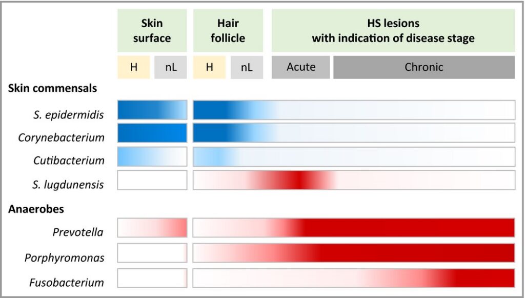 Your Body's Blueprint for Healing: A PhD's Guide to Taking Control of Hidradenitis Suppurativa f 2