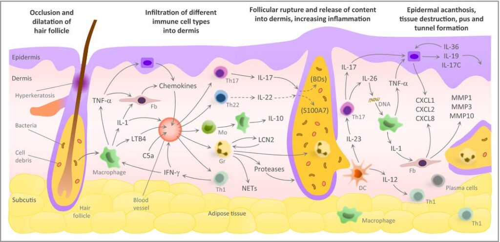 Your Body's Blueprint for Healing: A PhD's Guide to Taking Control of Hidradenitis Suppurativa f 3