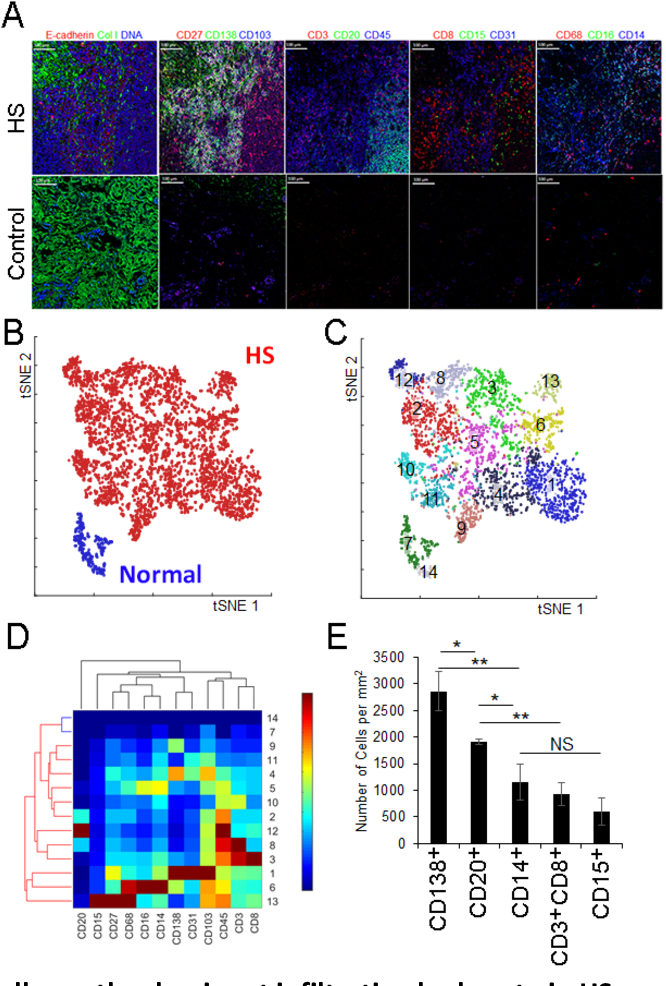 From Lab to Life: How B-Cell Research Validates a Natural Approach to Hidradenitis Suppurativa f 6