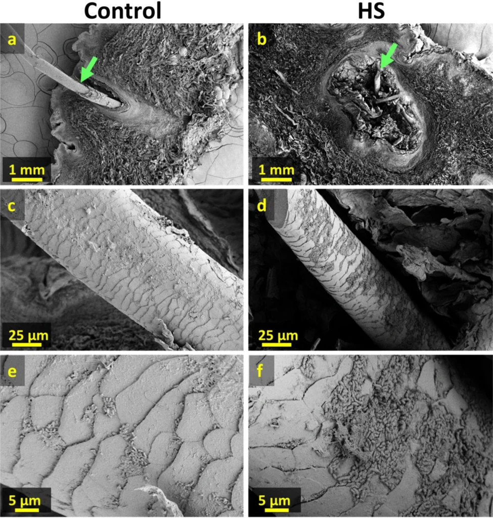 figure4
