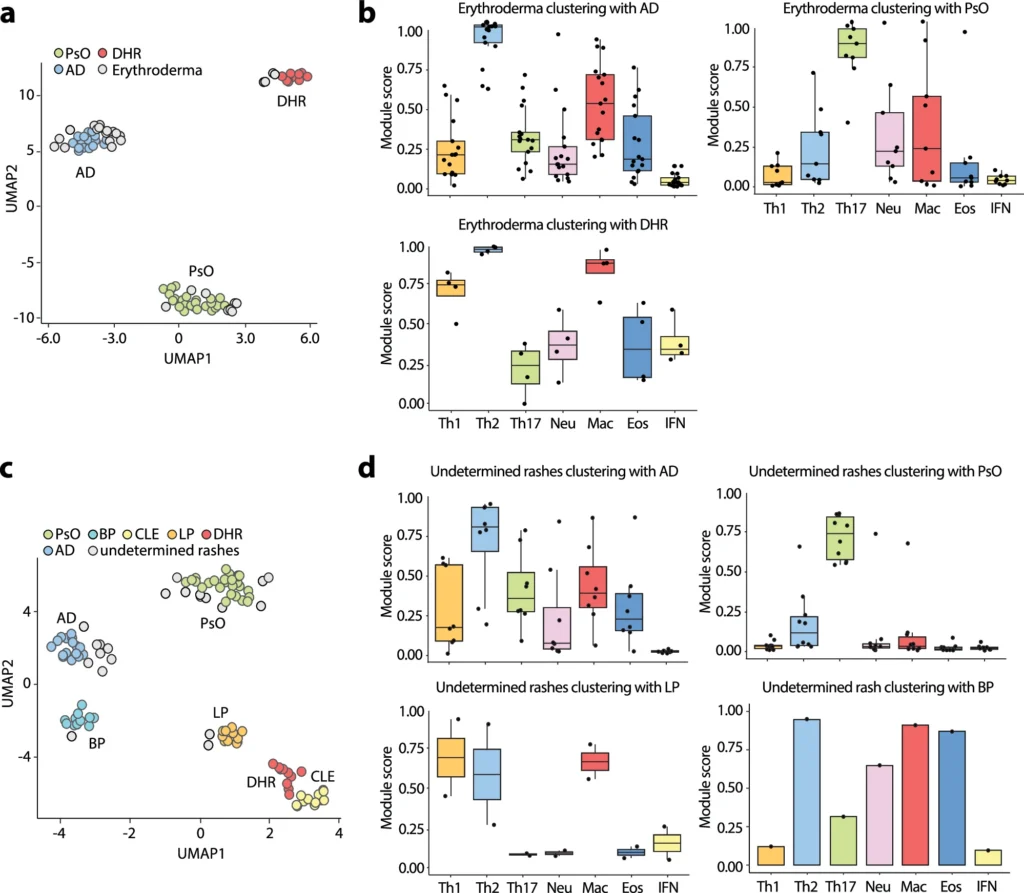 Hidradenitis Suppurativa & Your "Immune Fingerprint": New Science Reveals Why Treatments Fail and How to Truly Heal figure four