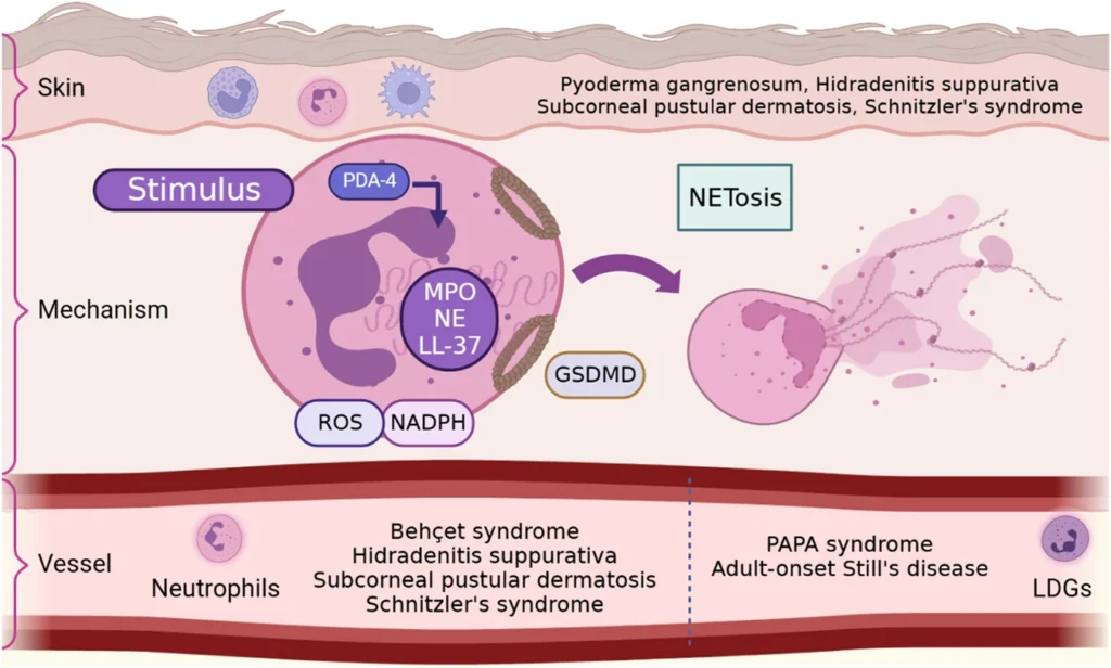 Can You Cure HS? Unpacking the Science of Neutrophil "Kamikaze Webs" in Hidradenitis Suppurativa figure 1