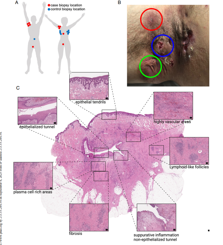 nebo 2024 figure 1