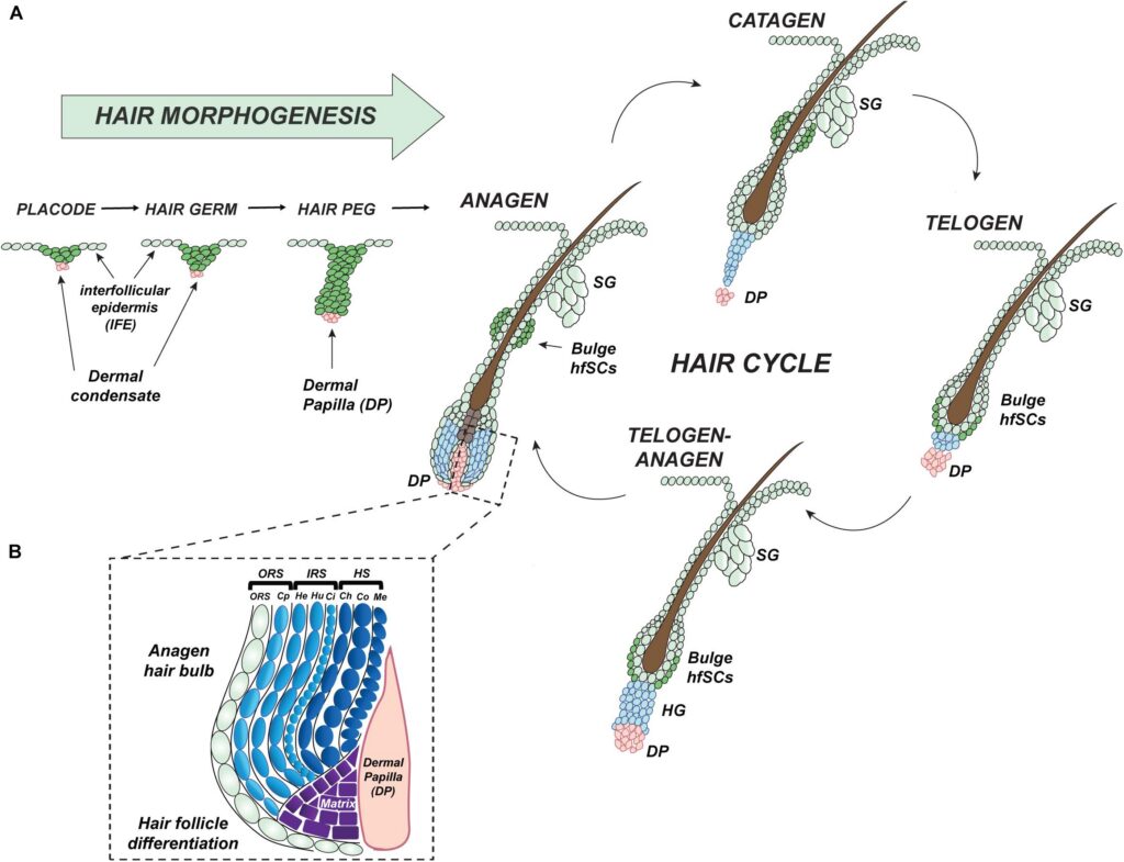 How a Broken Switch in Your Hair Follicle Could Triggers Hidradenitis Suppurativa: How to heal HS naturally. figure 2