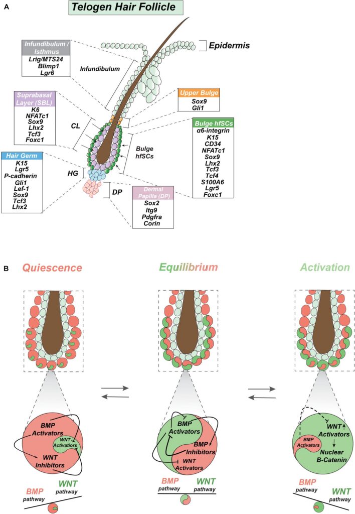 How a Broken Switch in Your Hair Follicle Could Triggers Hidradenitis Suppurativa: How to heal HS naturally. figure 3