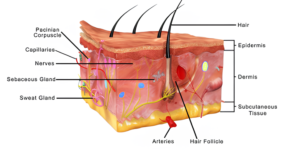 hidradenitis suppurativa is painful skin(1)
