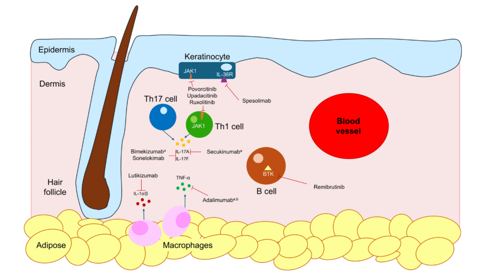 Biologics for Hidradenitis suppurativa and why they wont save you f 1