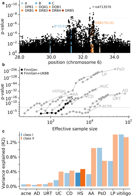 Stronger Confirmation: New Genetic Clue Solidifies Hidradenitis Suppurativa's Autoimmune Link gr1