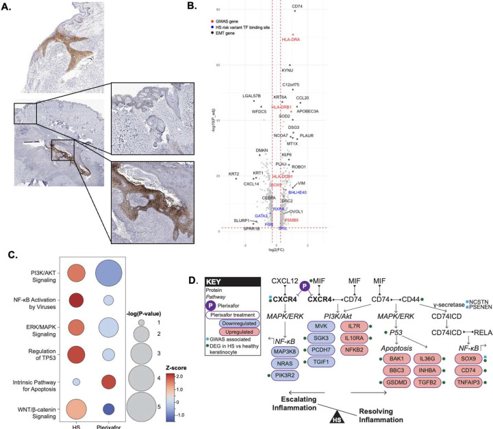 Beyond the Surface: New Genetic Clues Reveal How to Truly Treat Hidradenitis Suppurativa nihpp 2025.07.25.25332168v1 f0002